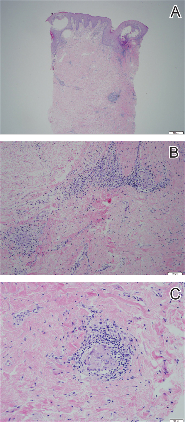 Figure2