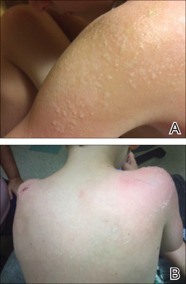 Figure2