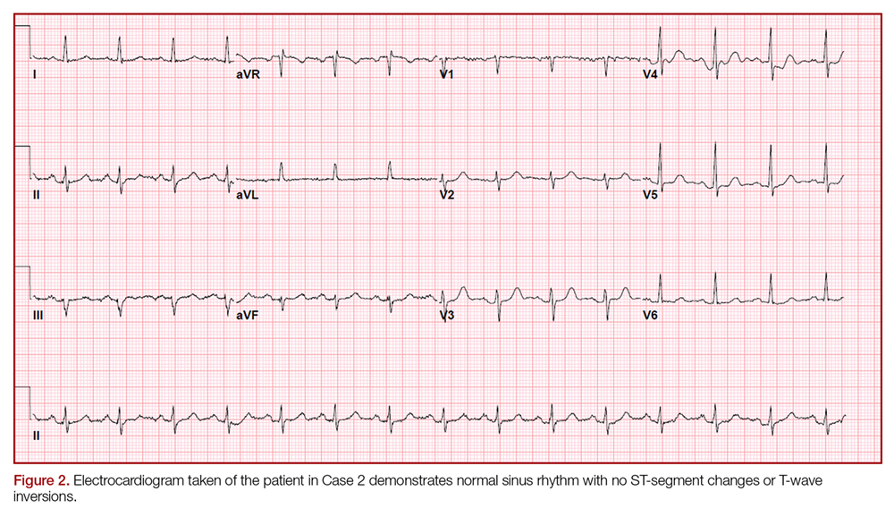 Asystole Following Nitroglycerin: A Review of Two Cases | MDedge ...