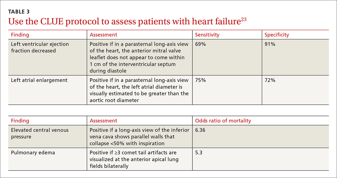 Use the CLUE protocol to assess patients with heart failure image