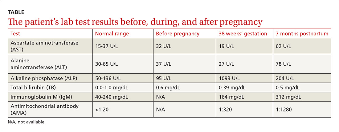 Elevated Serum Alkaline Phosphatase Generalized Pruritus Dx 