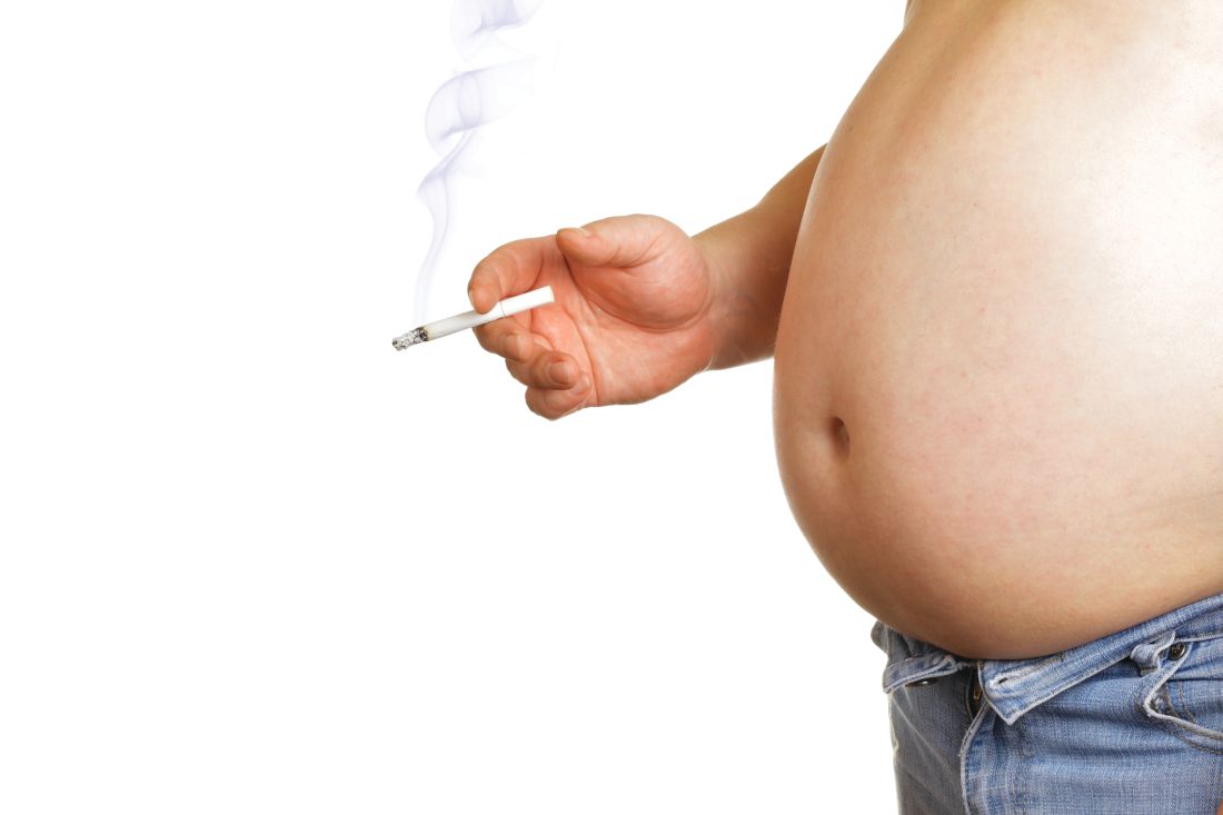Withholding elective surgery in smokers, obese patients | MDedge ObGyn