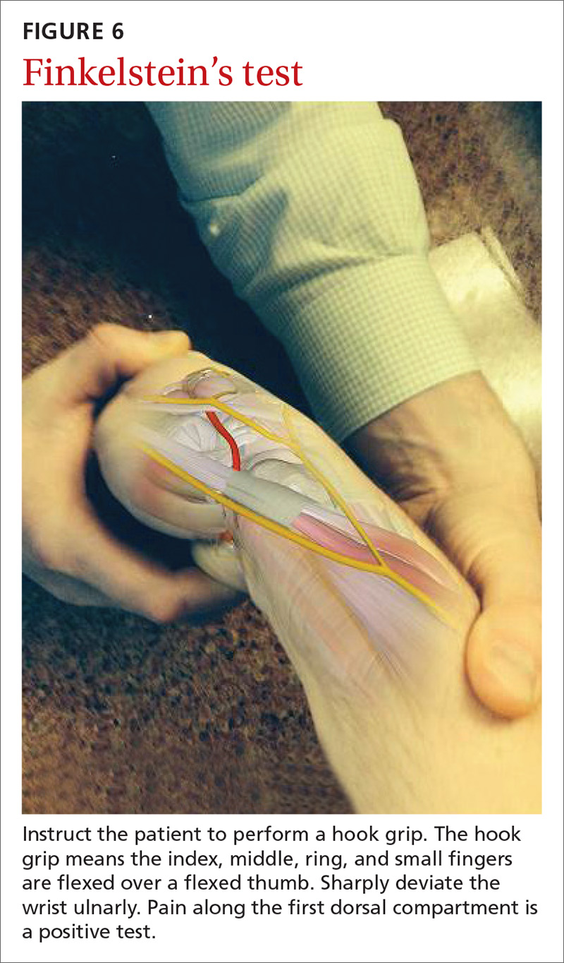 Styloid Process Of Radius Pain