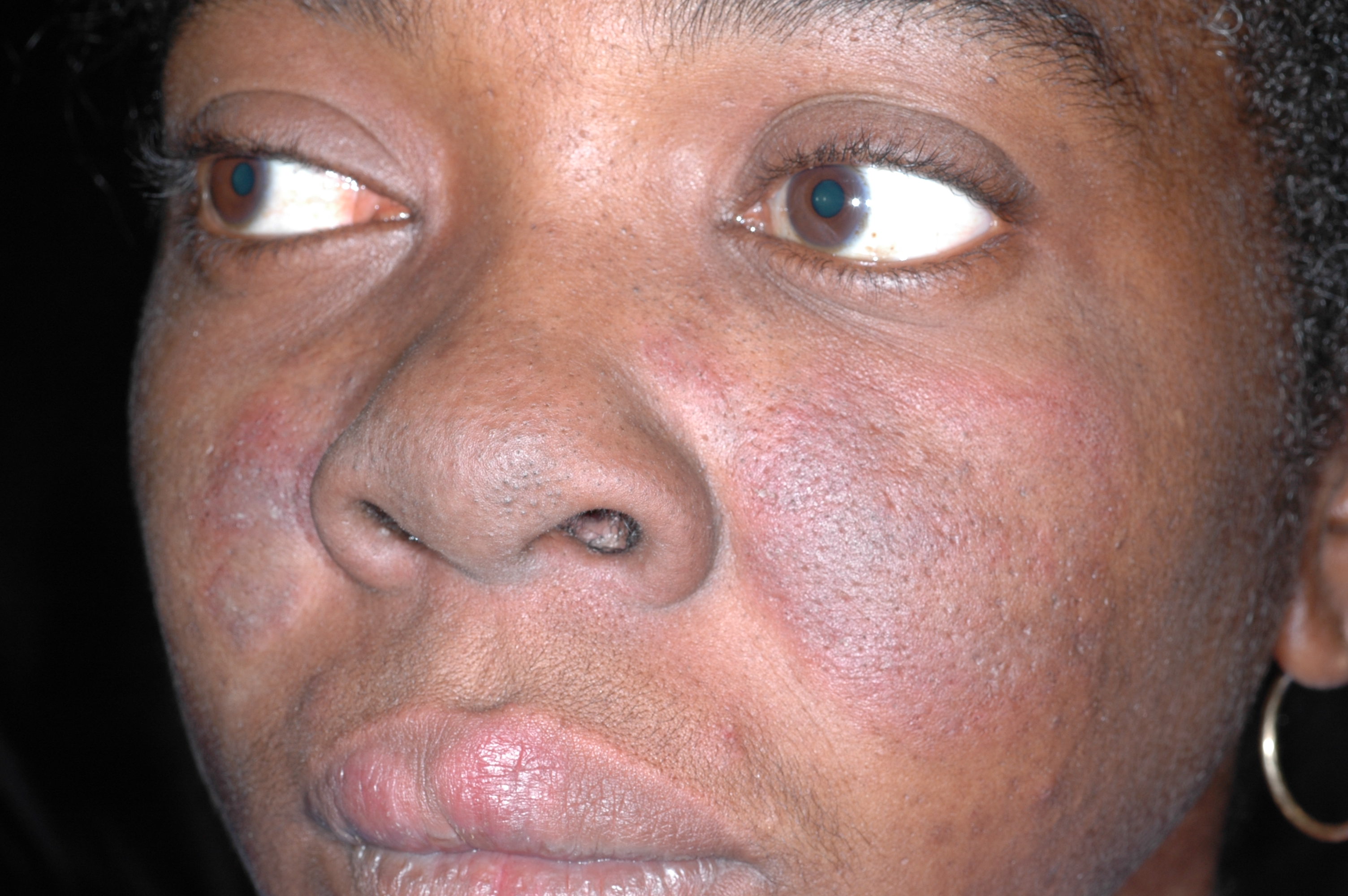 What Happens When You See Dark Spots