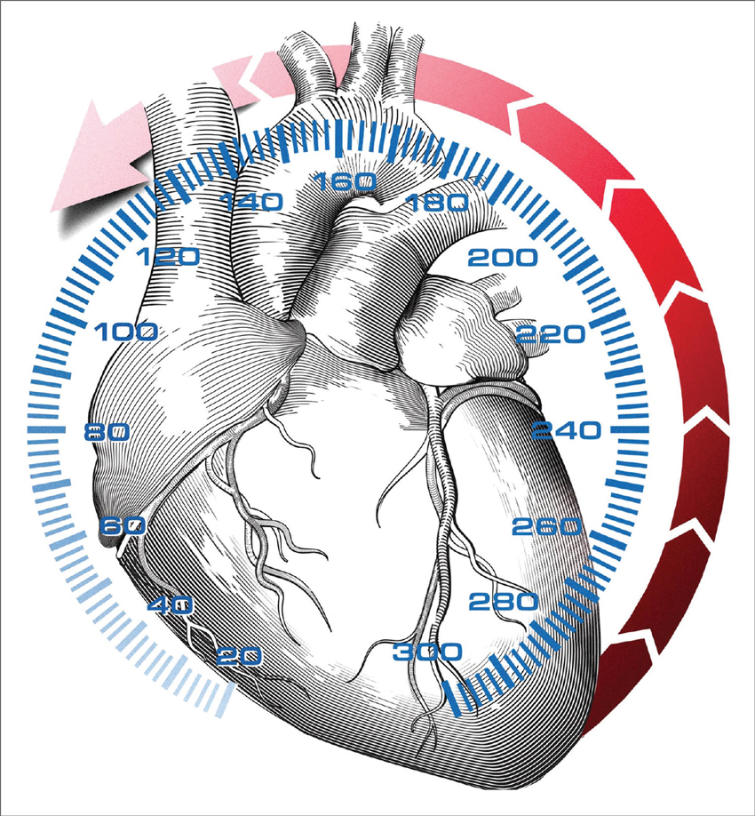 Blood pressure targets: How low should you go (and for whom)?