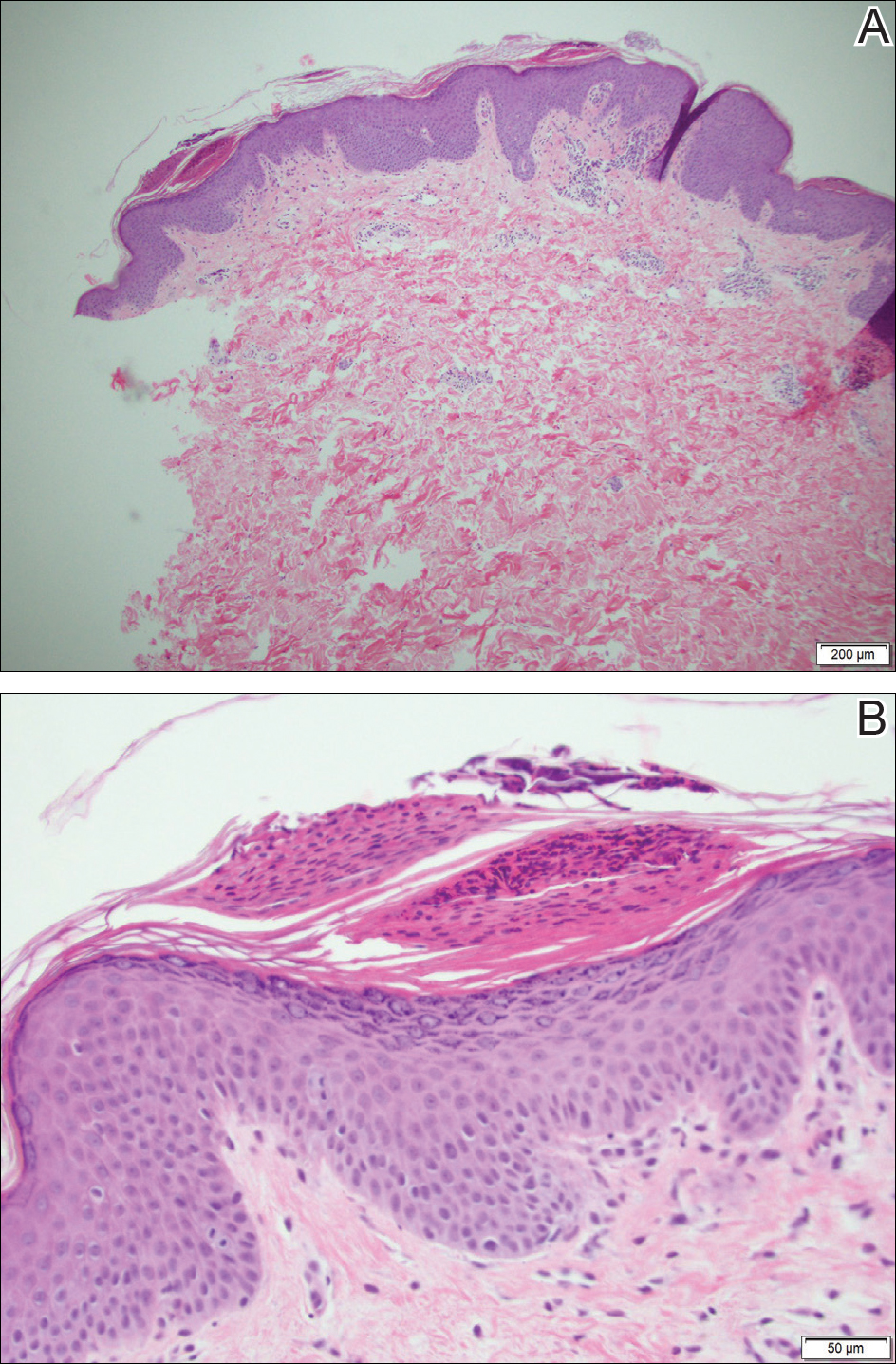 Figure1