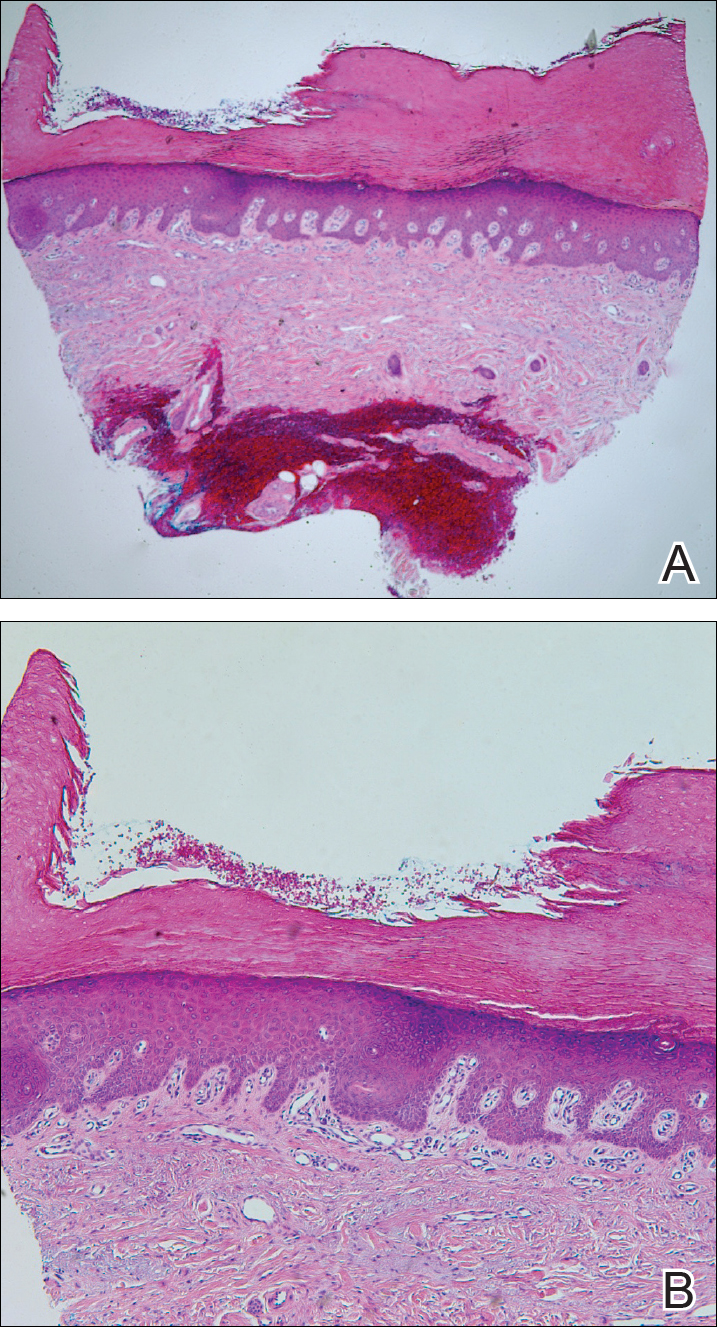 Figure1