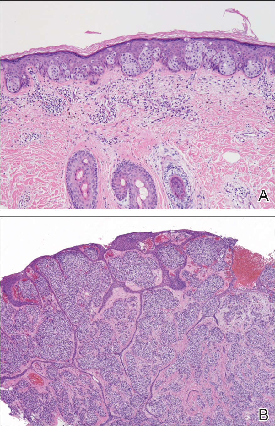 Figure2