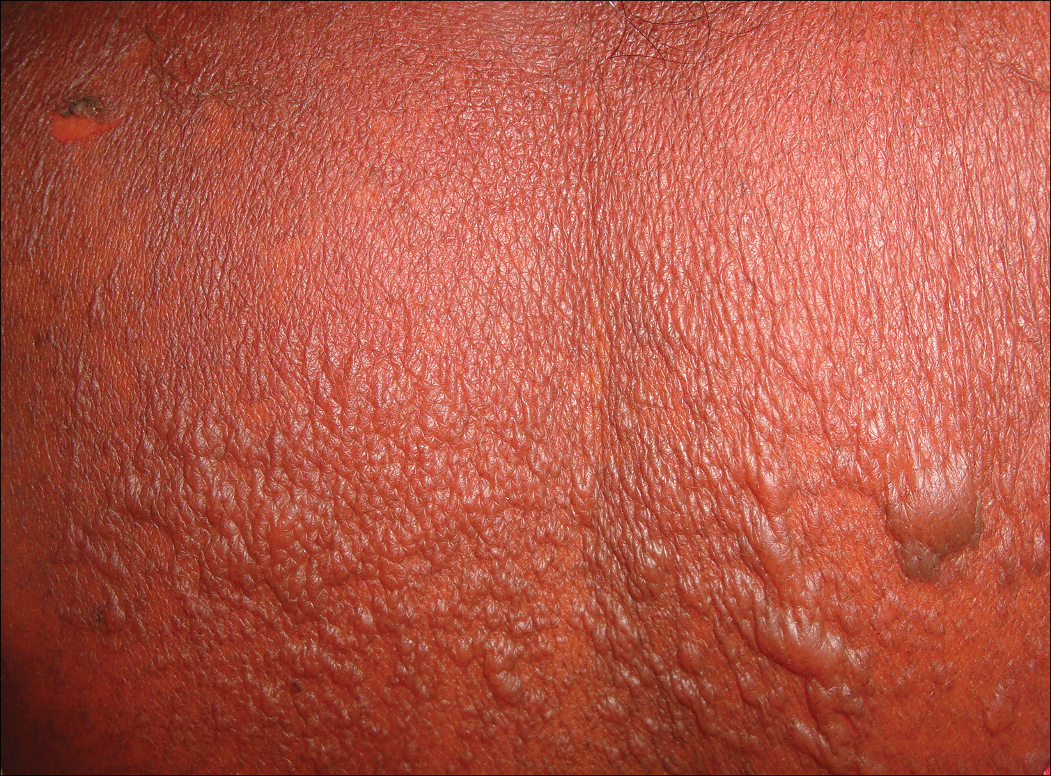 Figure2