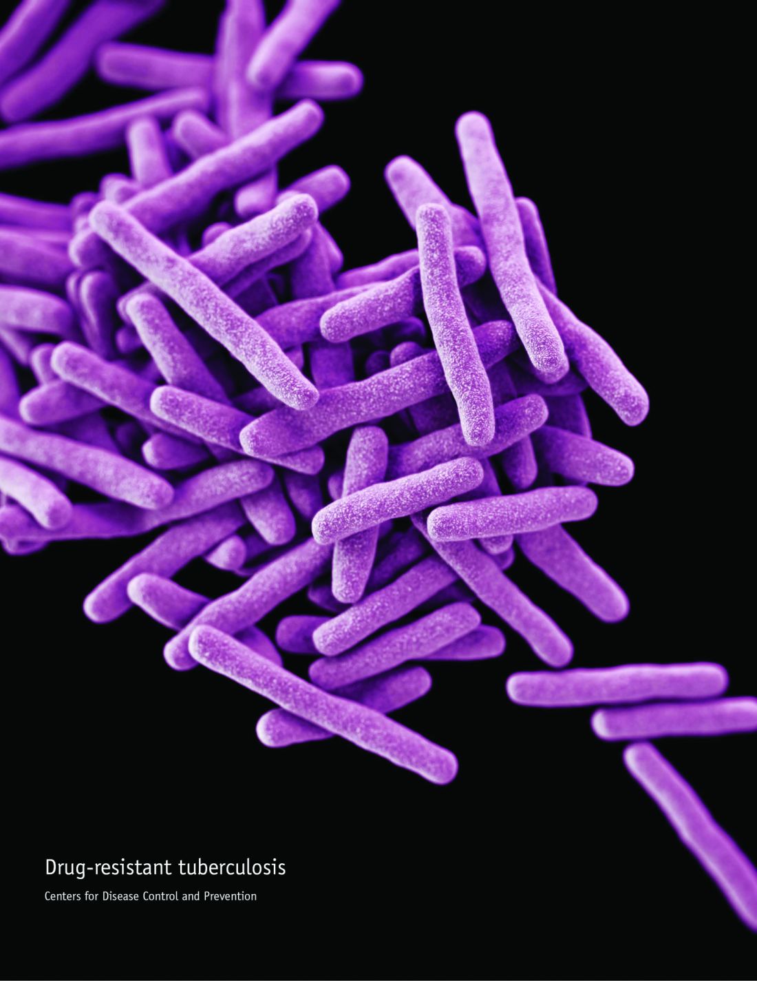 Tuberculosis test