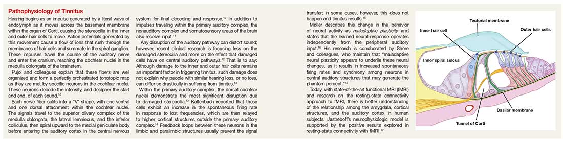 Pathophysiology of Tinnitus