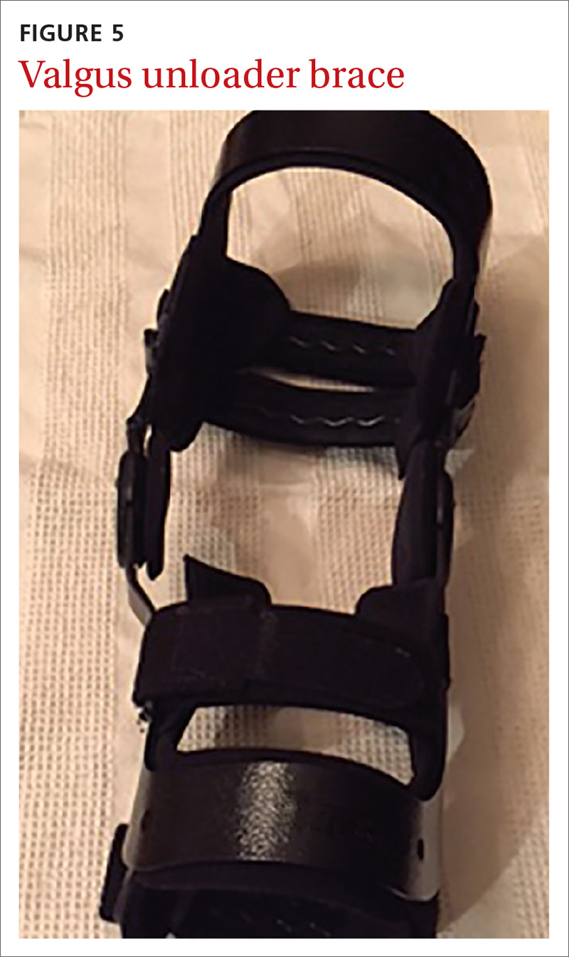 Valgus unloader brace