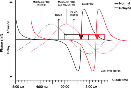 dspd light therapy