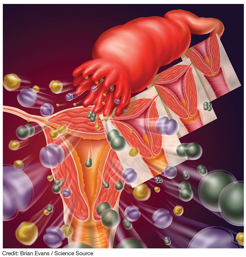 pelvic inflammatory disease bacteria