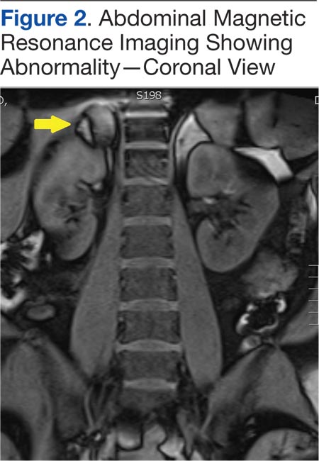 Flank pain  MDedge Family Medicine