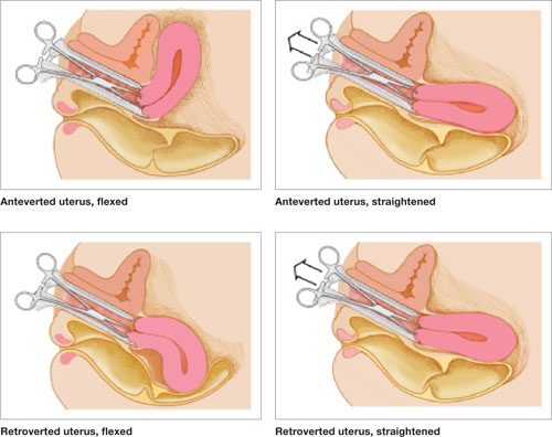 UPDATE MINIMALLY INVASIVE SURGERY MDedge ObGyn