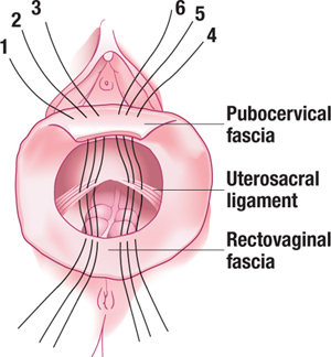 rectovaginal fascia