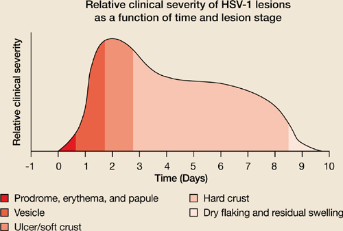 short-course-therapy-for-recurrent-genital-herpes-and-herpes-labialis