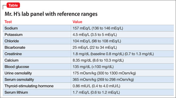 diabetes insipidus test results)