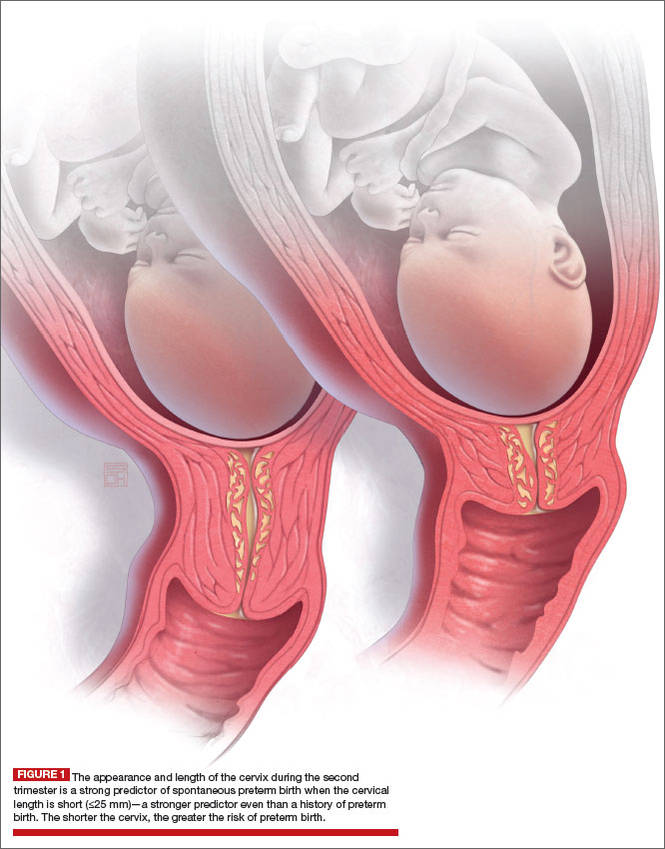 cervix anatomy during pregnancy