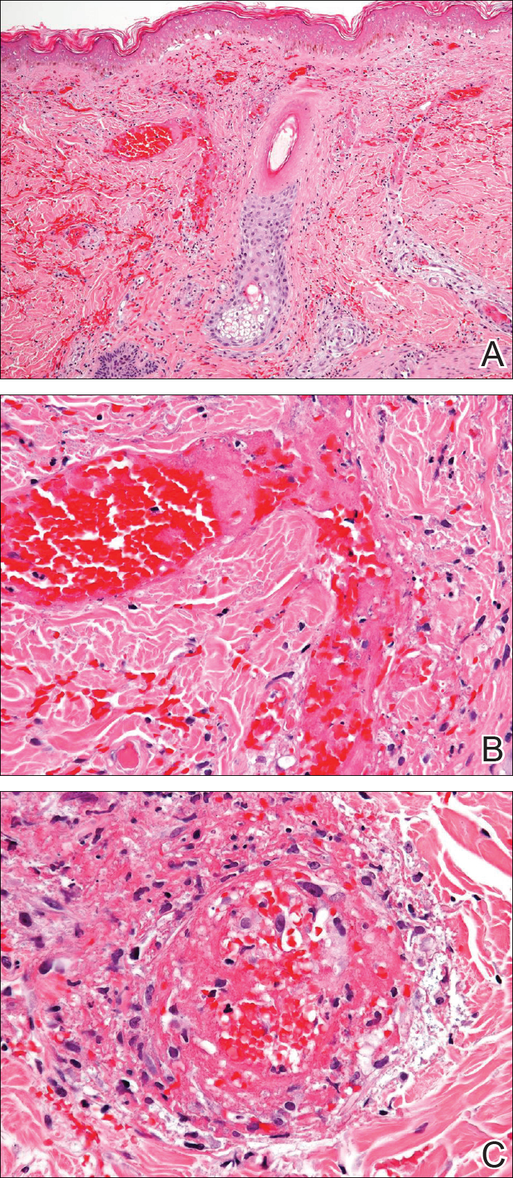 Figure2