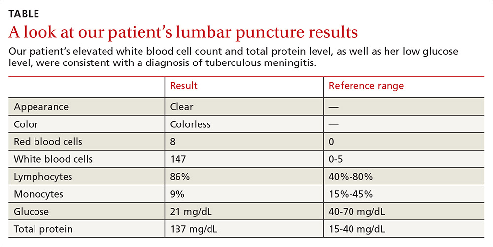 Un vistazo a la imagen de los resultados de la punción lumbar de nuestra paciente's lumbar puncture results image