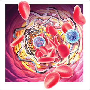 The art of delivering evidence-based dual antiplatelet therapy