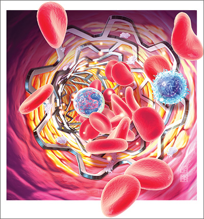 The art of delivering evidence-based dual antiplatelet therapy