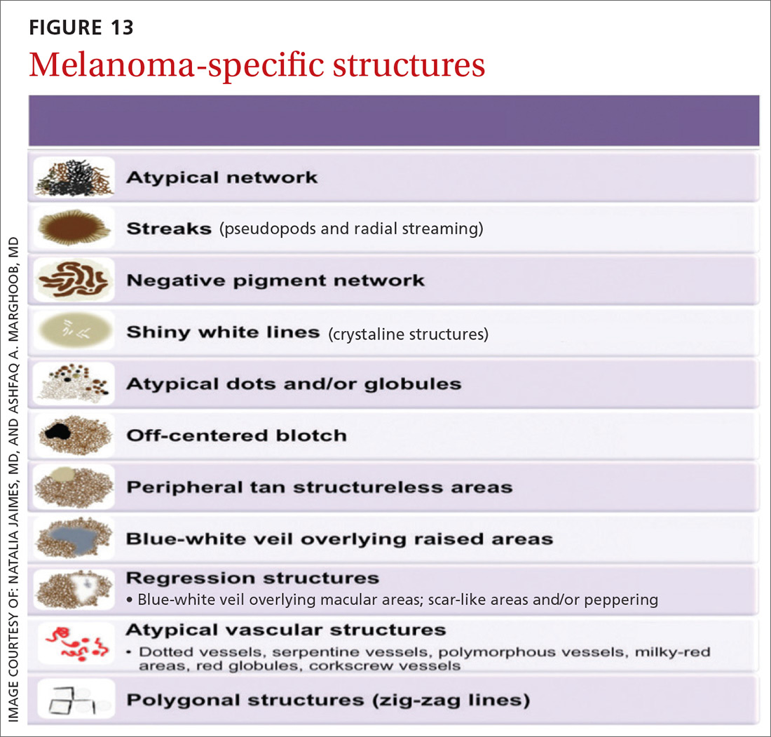 Melanoma-specific structures