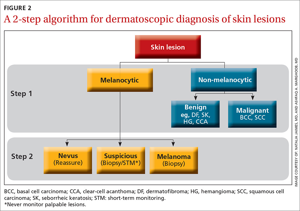 A 2-step algorithm for dermatoscopic diagnosis of skin lesions