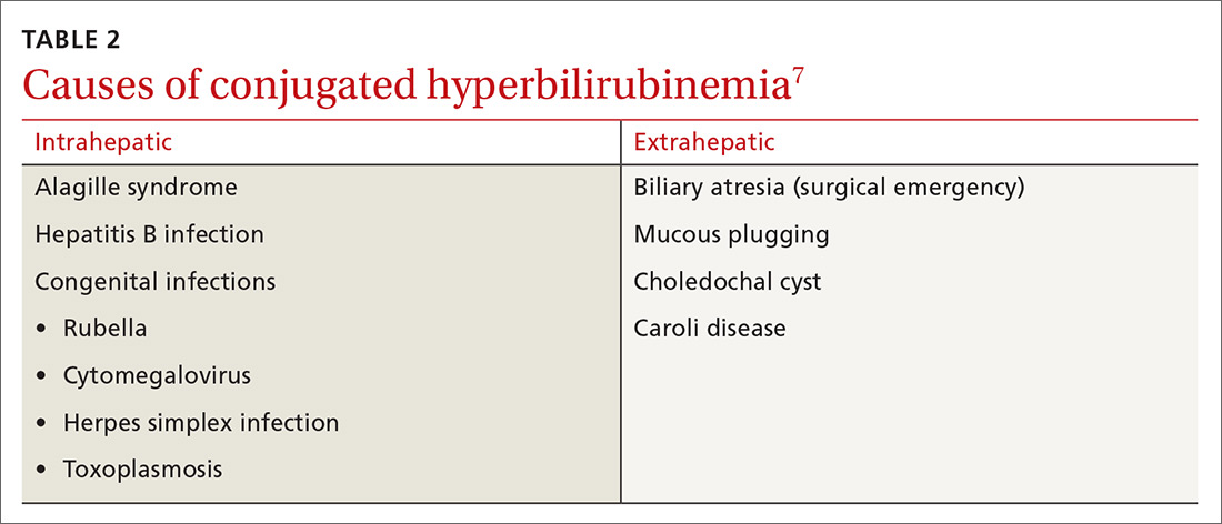 literature review hyperbilirubinemia
