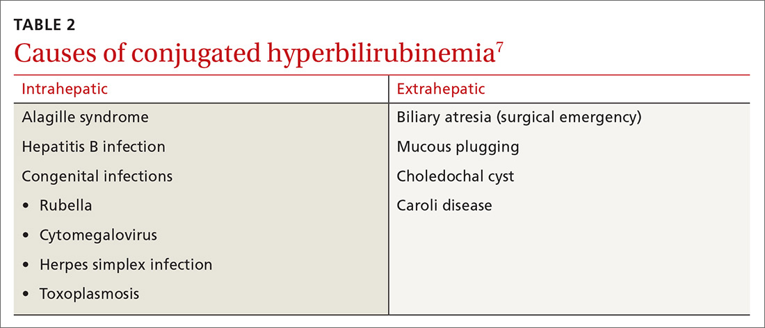 Neonatal Hyperbilirubinemia An Evidence based Approach MDedge Family 