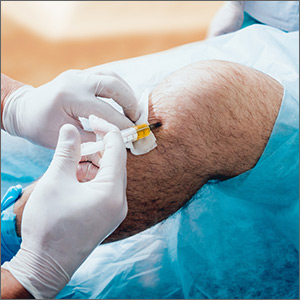 Is intra-articular platelet-rich plasma injection an effective treatment for knee OA?