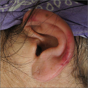 Pain in left ear