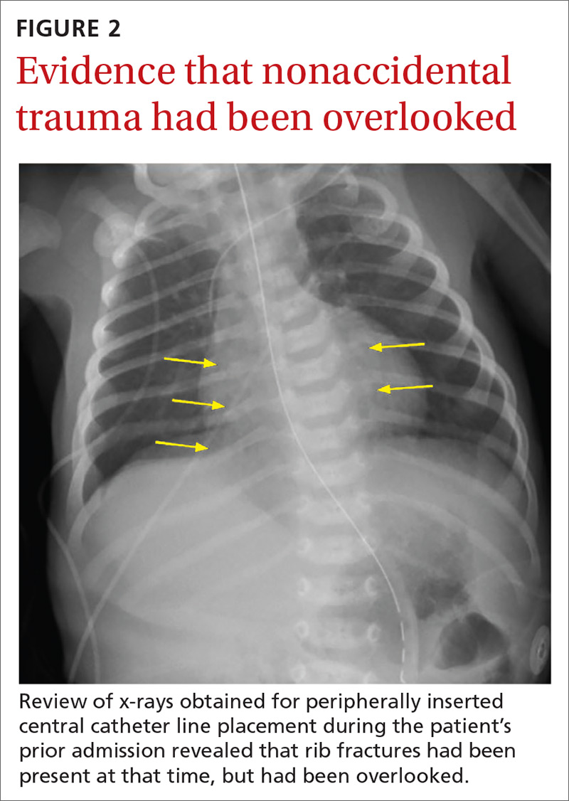 Evidence that nonaccidental trauma had been overlooked