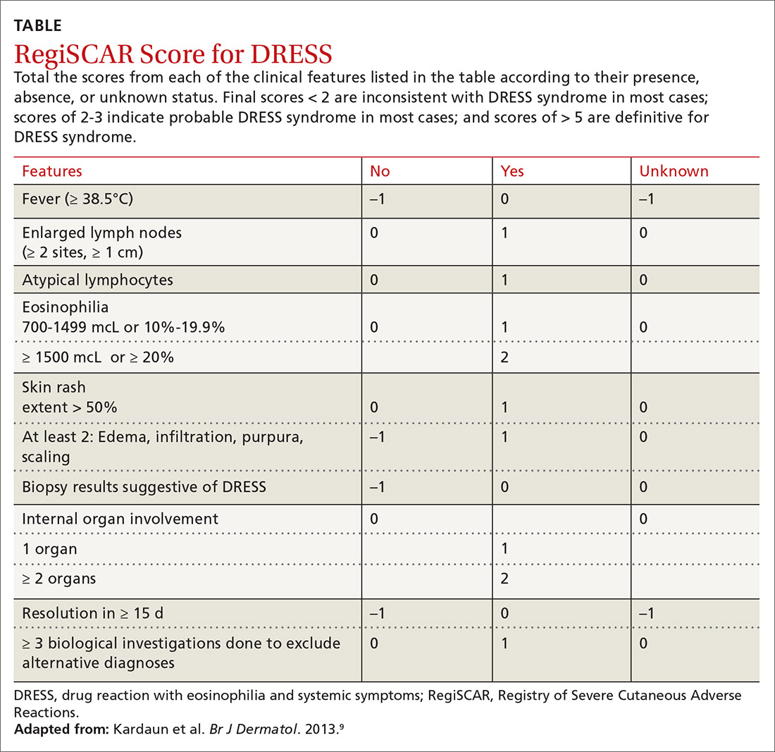 RegiSCAR Score for DRESS