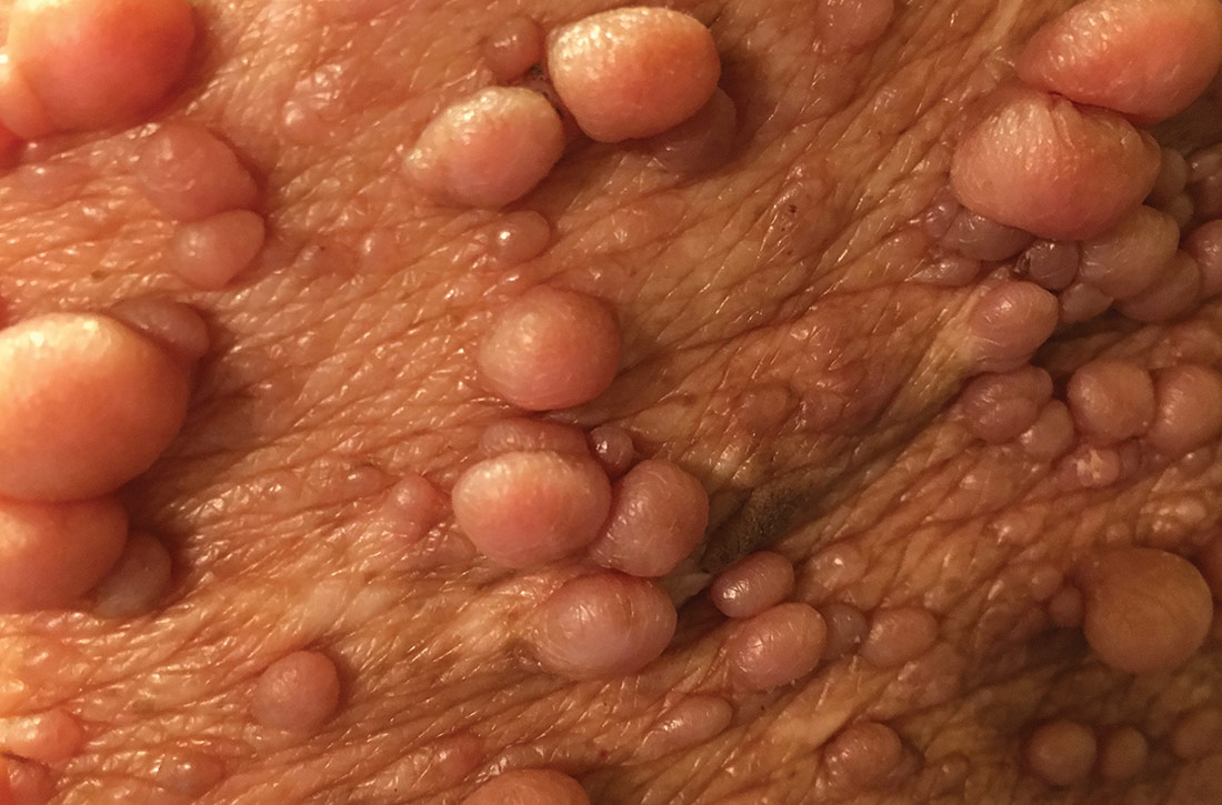 Prepubertal  pussy closeup 