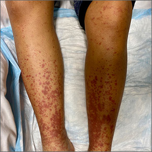 red spots covering legs 