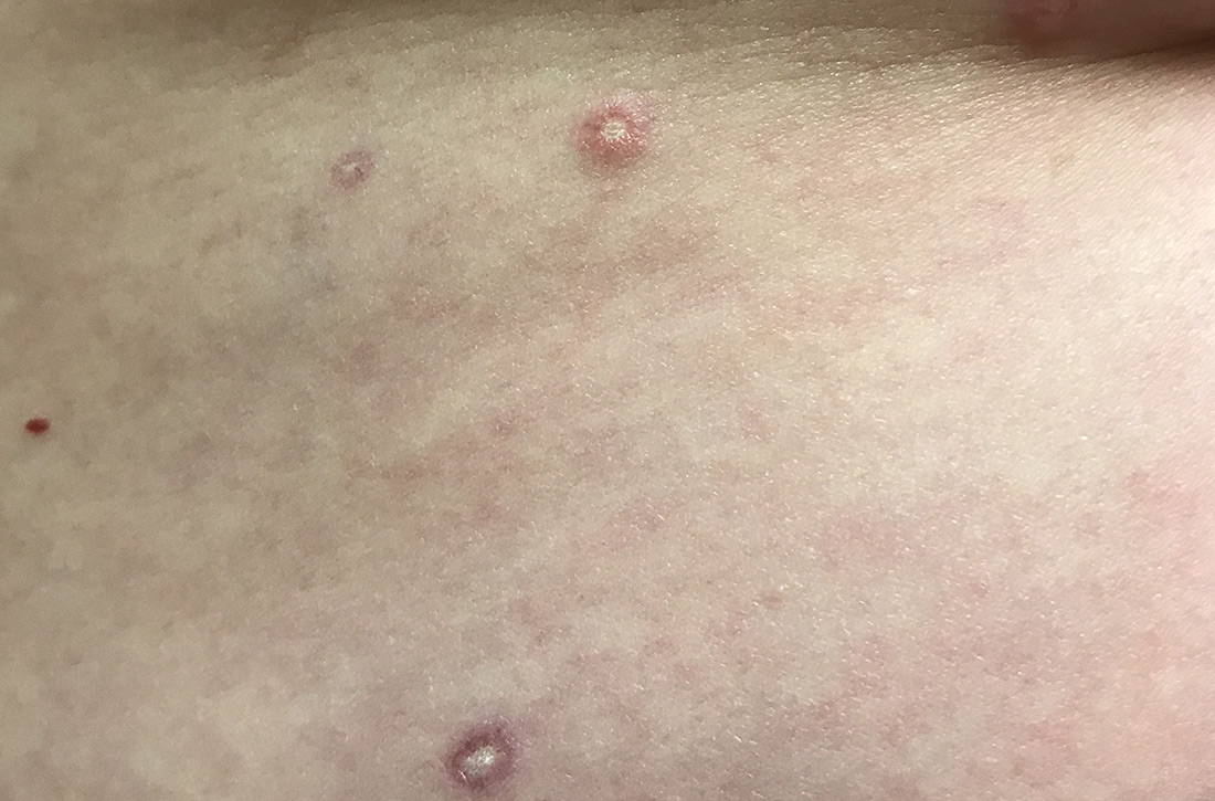 red marks on skin