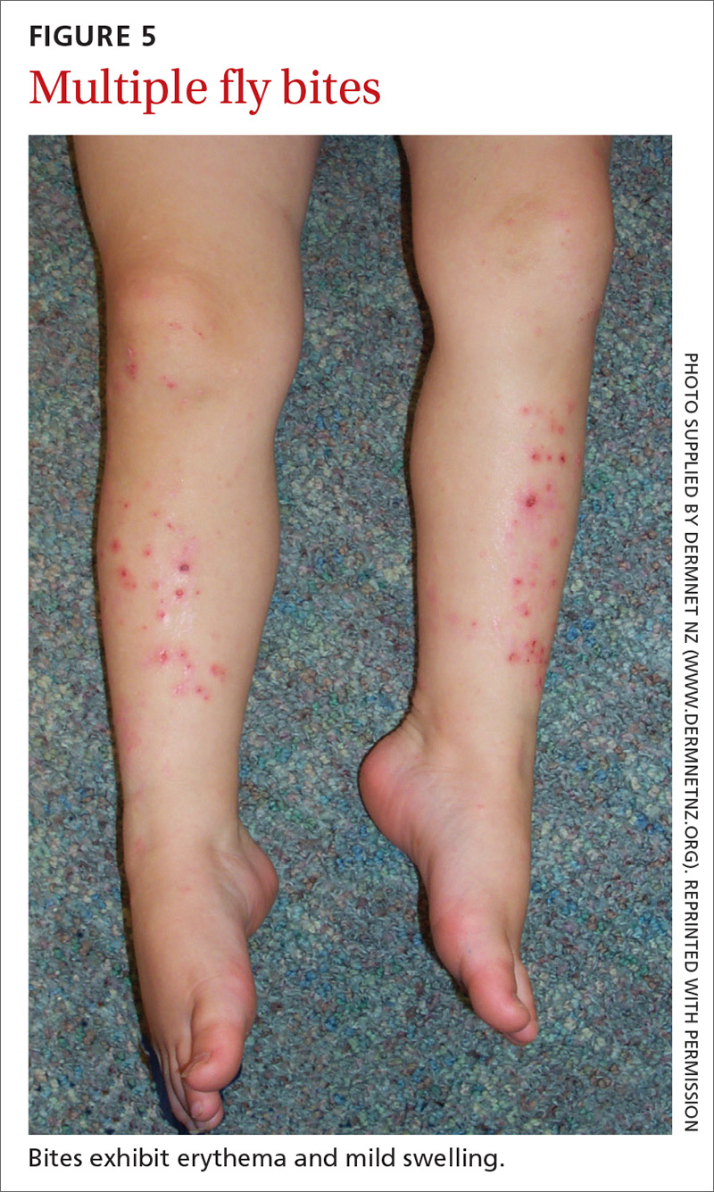 Red spots over legs