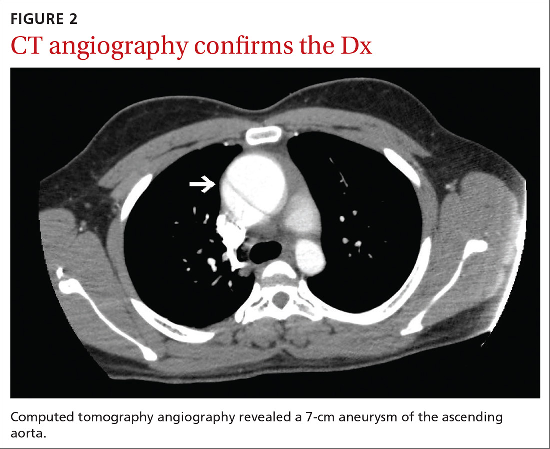 Computed tomography angiography