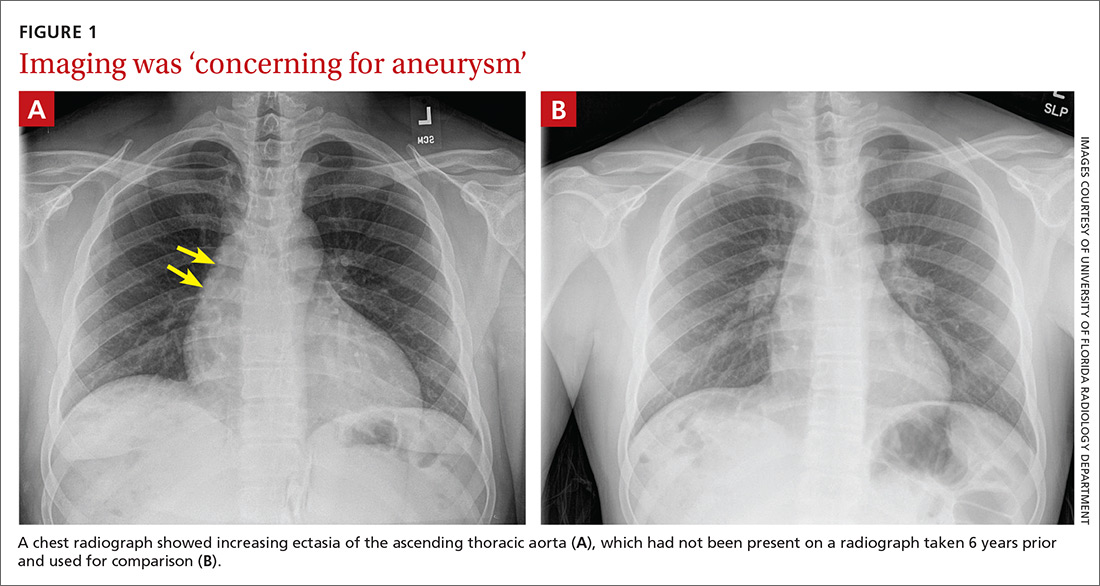 Chest radiograph