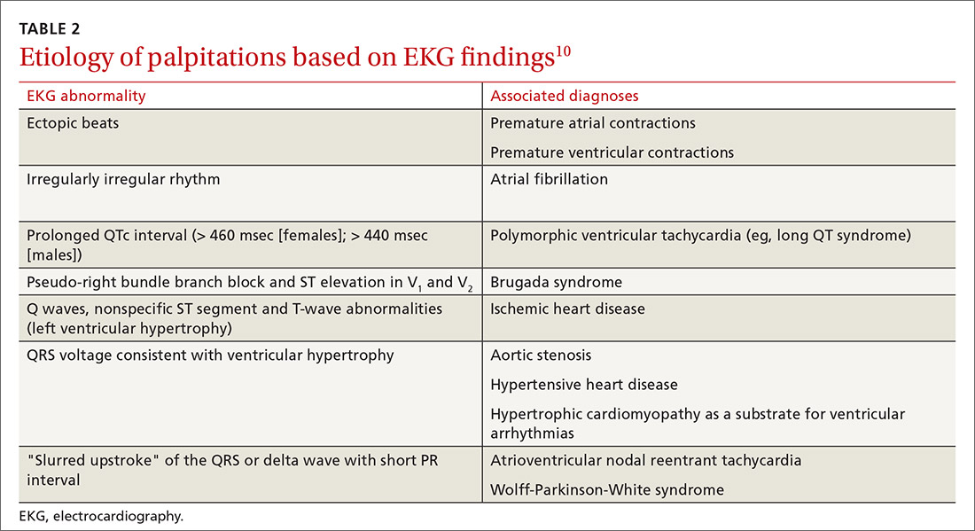 Etiology of palpitations based on EKG findings