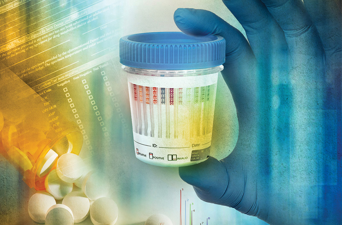 Urine drug screening