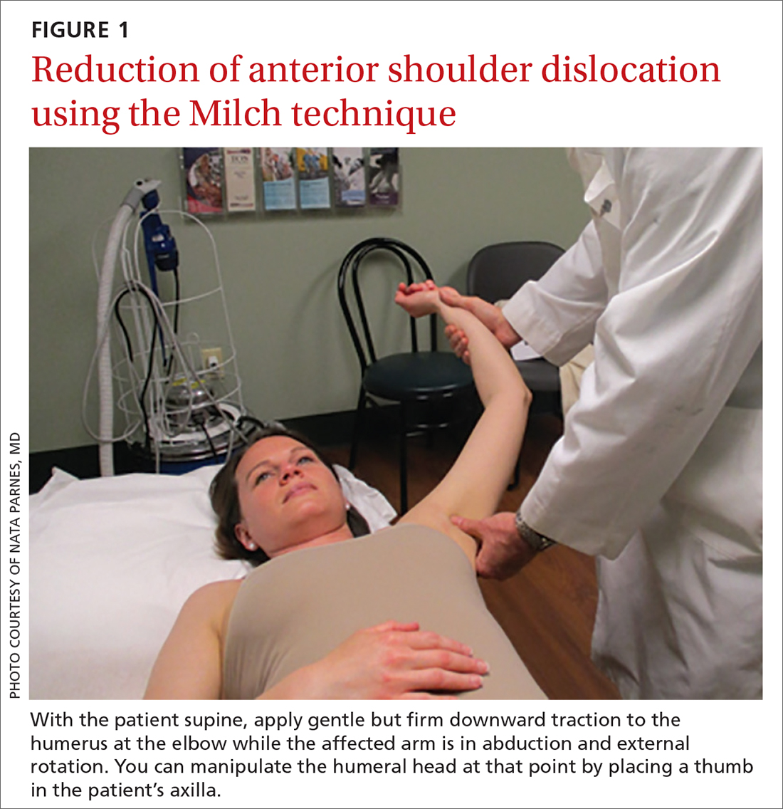 Reduction of anterior shoulder dislocation using the Milch technique