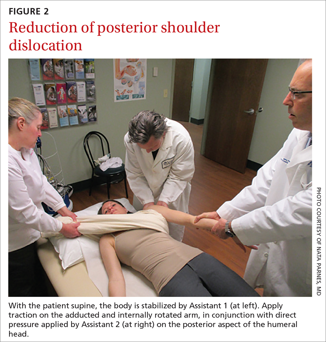 Reduction of posterior shoulder dislocation
