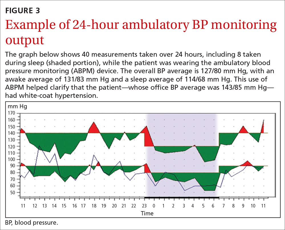 Example of 24-hour ambulatory BP monitoring output 