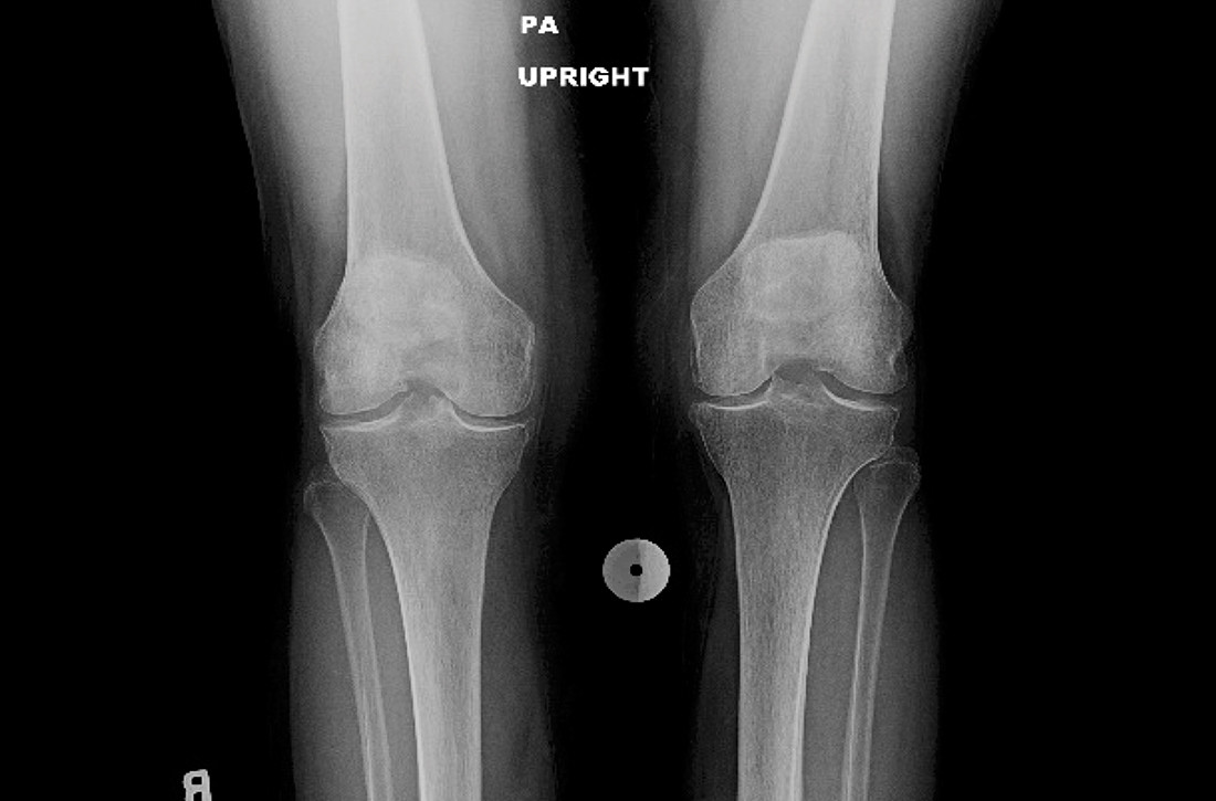 Knee x-ray provided no explanation for the patient’s pain