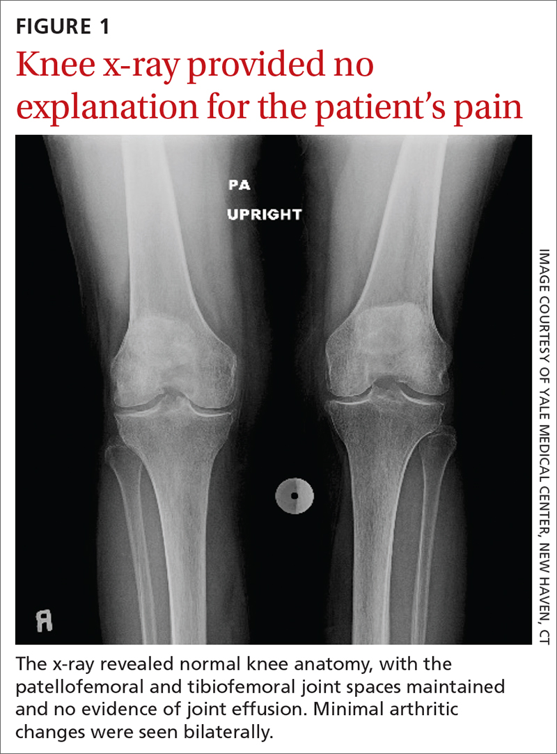 Knee x-ray provided no explanation for the patient’s pain