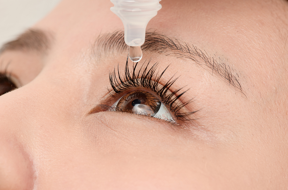 Woman putting eyedrops in her eye